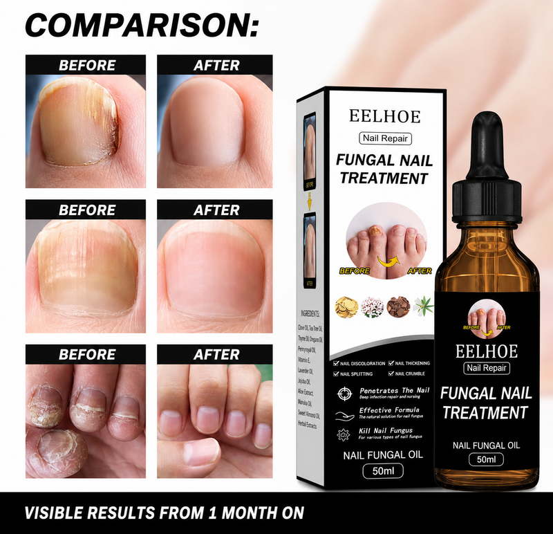 Fungal Nail Treatment Oil