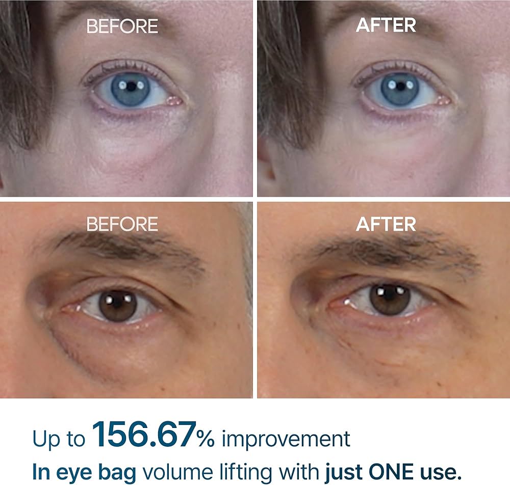 Dr. Melaxin Eyephalt Eyebag Cream