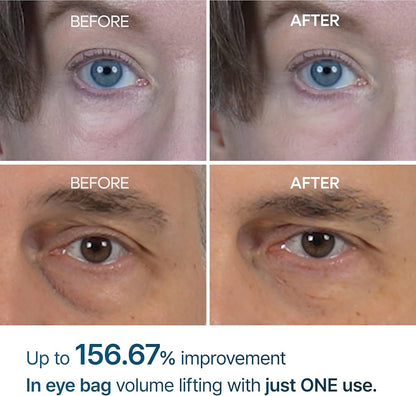 Dr. Melaxin Eyephalt Eyebag Cream