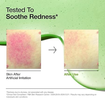 ANUA Azelaic Acid 10 Hyaluron Redness Soothing Serum 30ml